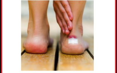 Podiatrist talks about Foot Blisters