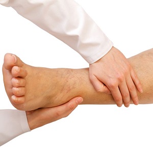 Professional massage for swollen leg