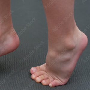 Stretch by standing on tippy toes for plantar fascia pain