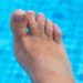 Foot with webbed toes Syndactyly
